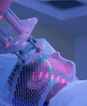 Stereotactic Radiosurgery for Brain Metastases in Palestine: First Nationwide Study  in a Resource-Limited Setting